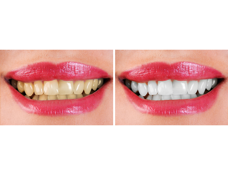 Foto 3 de Plus Life Odontologia Avançada BH