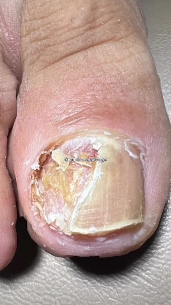 Foto 2 de PodoHome Podologia Clínica ®️