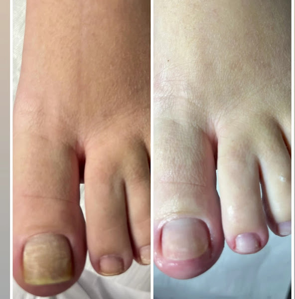 Foto 2 de PODÓLOGA CAROLINE SILVA