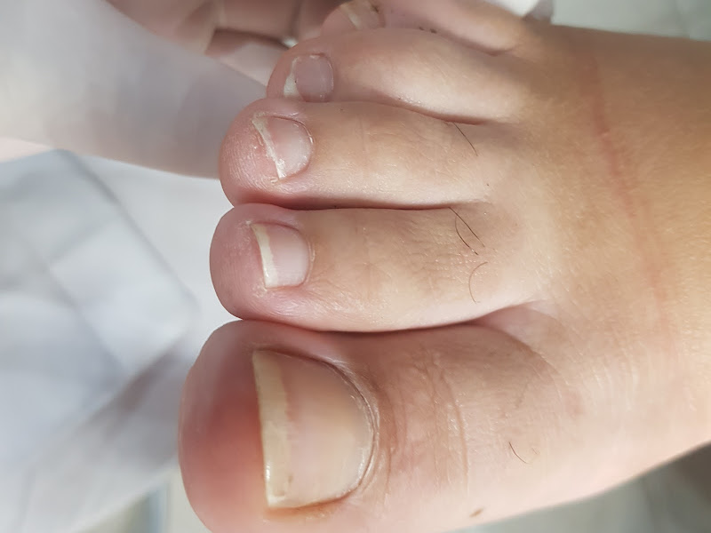 Foto 8 de PODÓLOGA CAROLINE SILVA