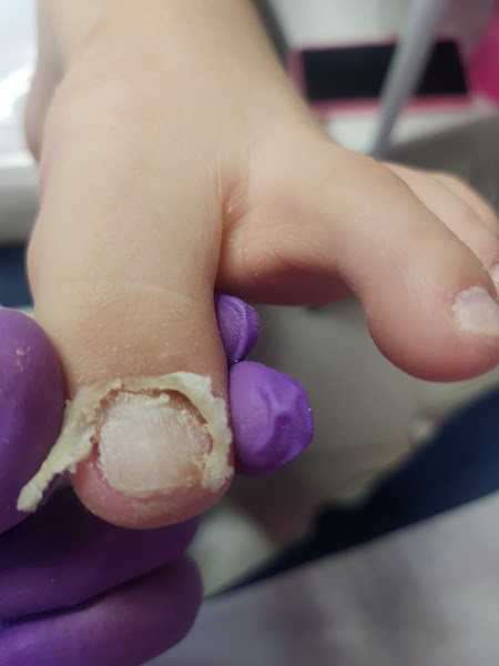 Foto 3 de Podologia Ale Gomes Clínica Angatu LAGO NORTE