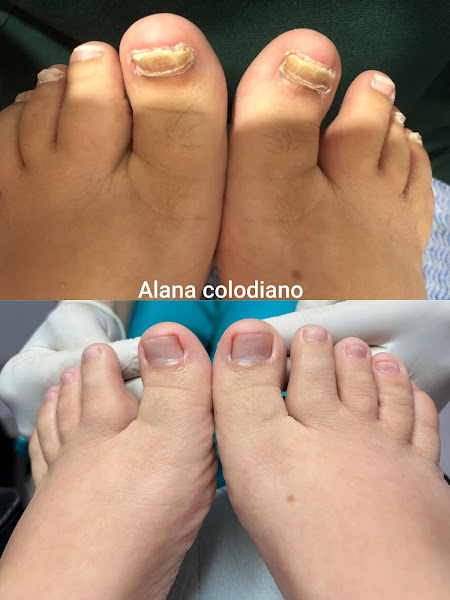 Foto 2 de Podologia clínica e estética avançada