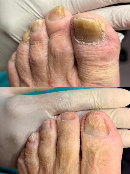 Foto 3 de Podologia clínica e estética avançada