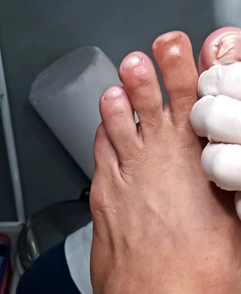 Foto 3 de Podologia eliene ferreira