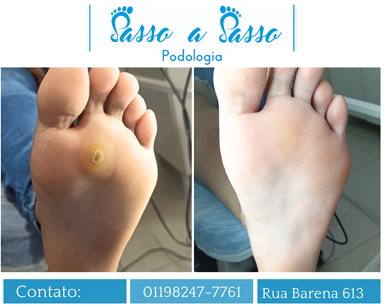 Foto 3 de Podologia Passo a Passo Itaim Paulista