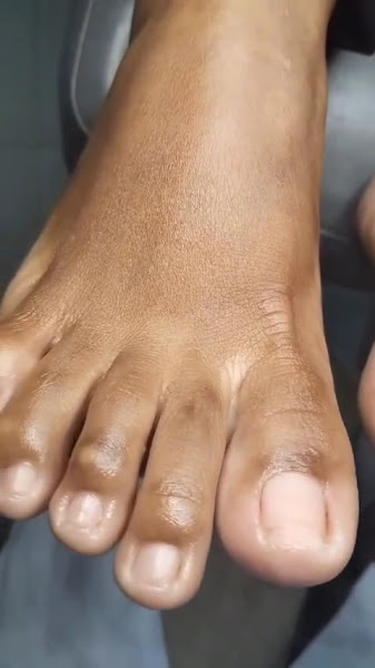 Foto 3 de Podologia Recife | Espinheiro