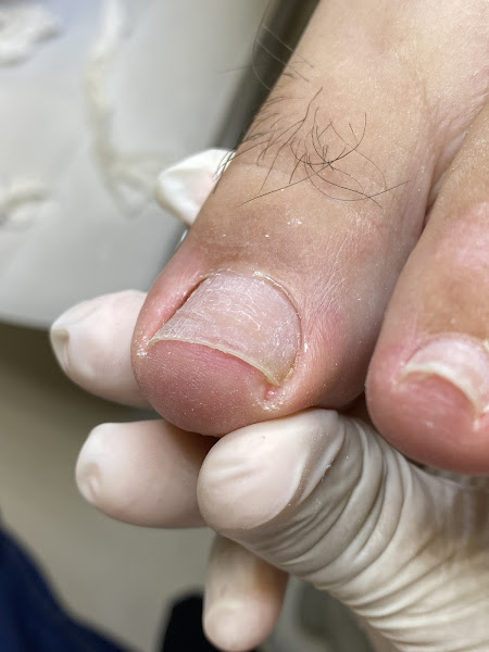 Foto 2 de Podólogo Rafael Gomes - Podologia Especializada