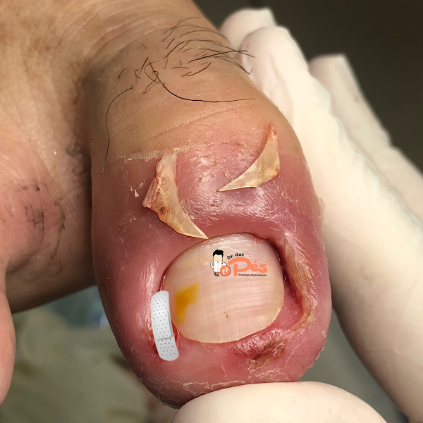 Foto 3 de Podólogo Rafael Gomes - Podologia Especializada