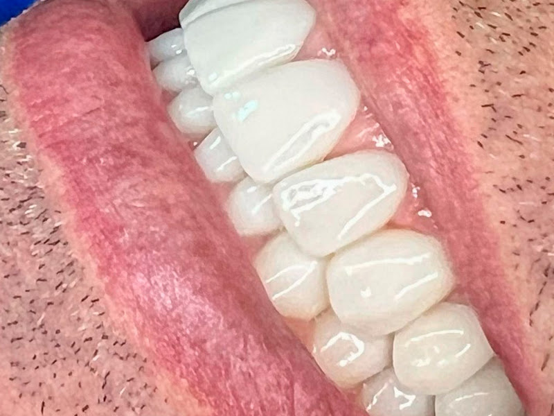 Foto 3 de Poenza Odontologia