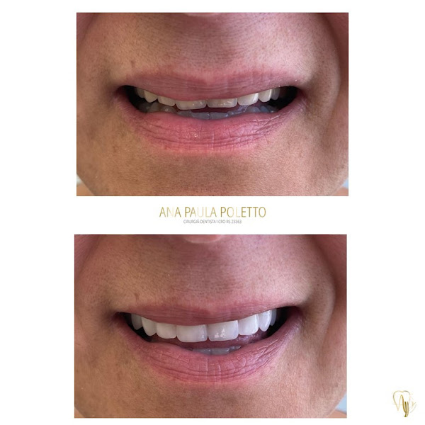 Foto 3 de Poletto e Gaboardi Odontologia