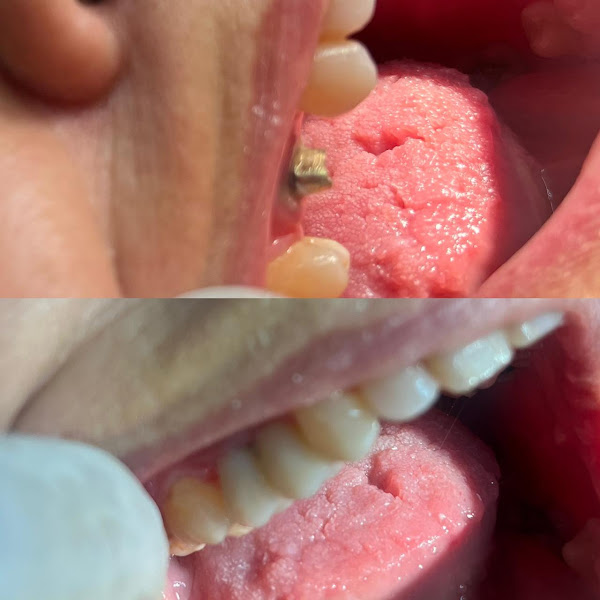 Foto 3 de Policlínica Dentária de Cabo Frio