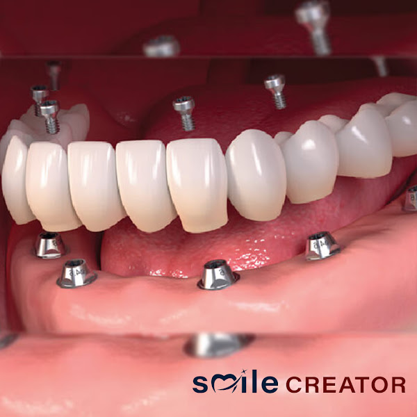 Foto 2 de Poliodonto Odontologia In Company