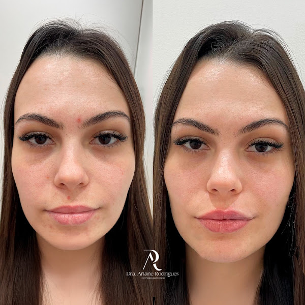 Foto 2 de Póllux Clínica Odontológica e Harmonização Facial