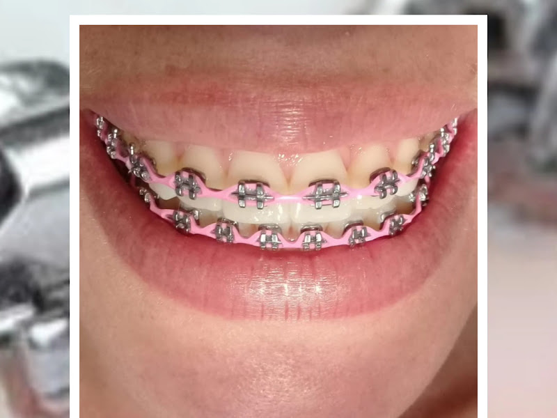 Foto de Ponssoni Consultório Dentário - Restinga