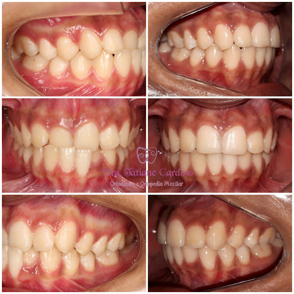 Foto 2 de POP DENT CLINICA ODONTOLOGICA