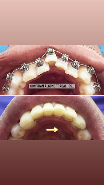 Foto 3 de POPCLIN ITAPUÃ