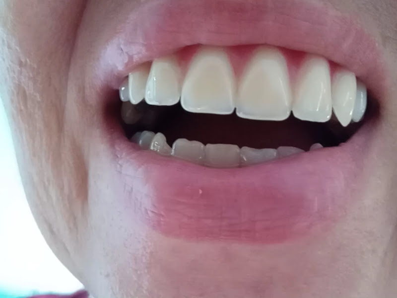 Foto 4 de ✅POPdents Fortaleza - Clínica 1