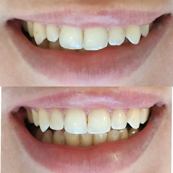 Foto 3 de Portella Pires Odontologia Especializada