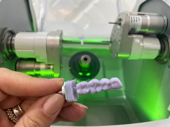 Foto 3 de Porto Odontologia - dentista em São Carlos