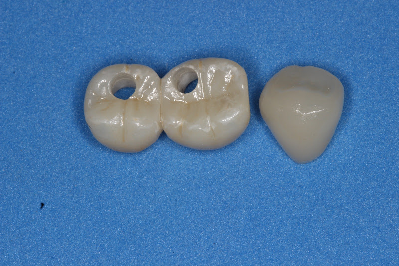 Foto 3 de Prado e Neves Odontologia Especializada | Dentista em Uberlândia