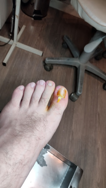 Foto 2 de Prazer dos Pés - Clínica de Podologia em Cachoeirinha