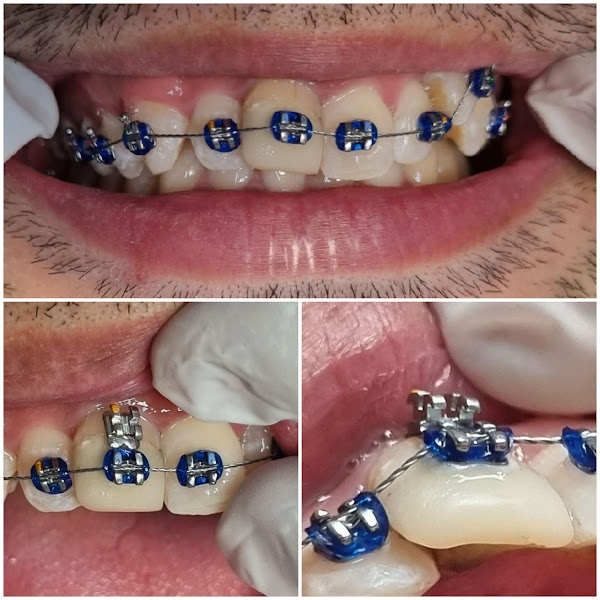 Foto 3 de Prazeres odontologia