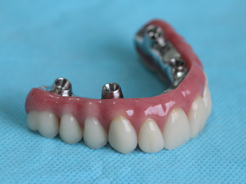 Foto 7 de Pre Oral Saúde