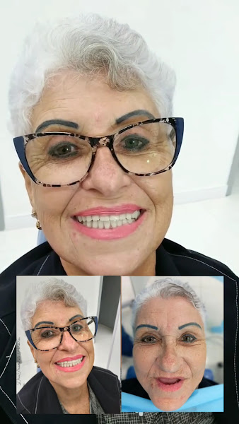 Foto 3 de Preciosa implantes