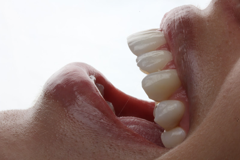 Foto 2 de Precision Dental Studio - Dentista Salvador - BA