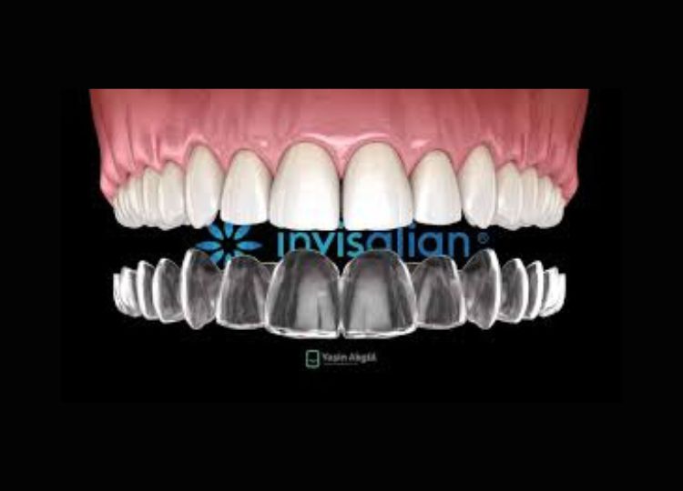 Foto 3 de PREDENTE Clínica Odontológica - Implantes Dentários, Próteses, Alinhadores Invisíveis