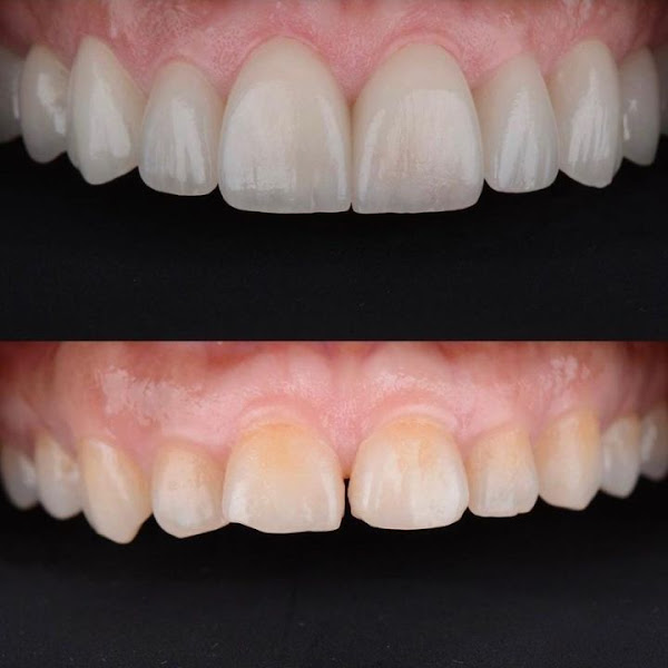 Foto 5 de PREDENTE Clínica Odontológica - Implantes Dentários, Próteses, Alinhadores Invisíveis