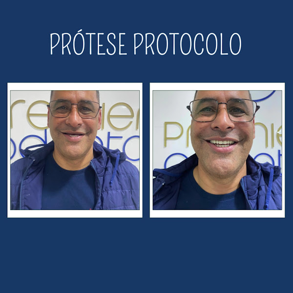 Foto 4 de Premier Odonto - Clínica Odontológica Especializada em Implantes Dentários