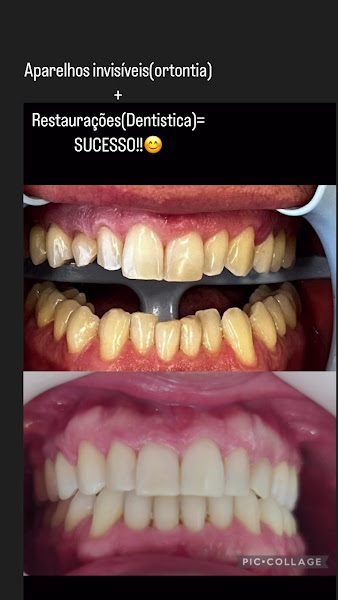 Foto 3 de Premier Odontologia | Implante dentário em Asa Norte | Invisalign em Asa Norte