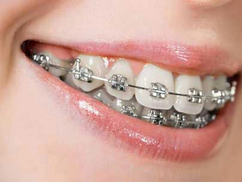 Foto 7 de Premium Odonto