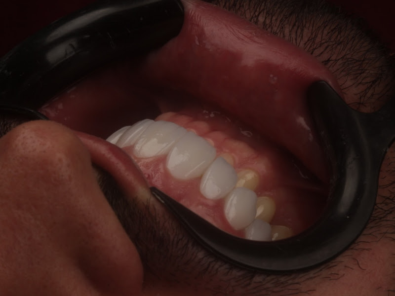 Foto 4 de PREMIUM ODONTOLOGIA