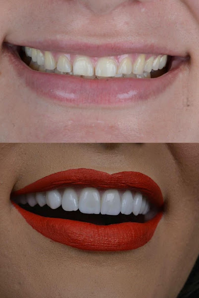 Foto 3 de PREMIUM ODONTOLOGIA ESPECIALIZADA