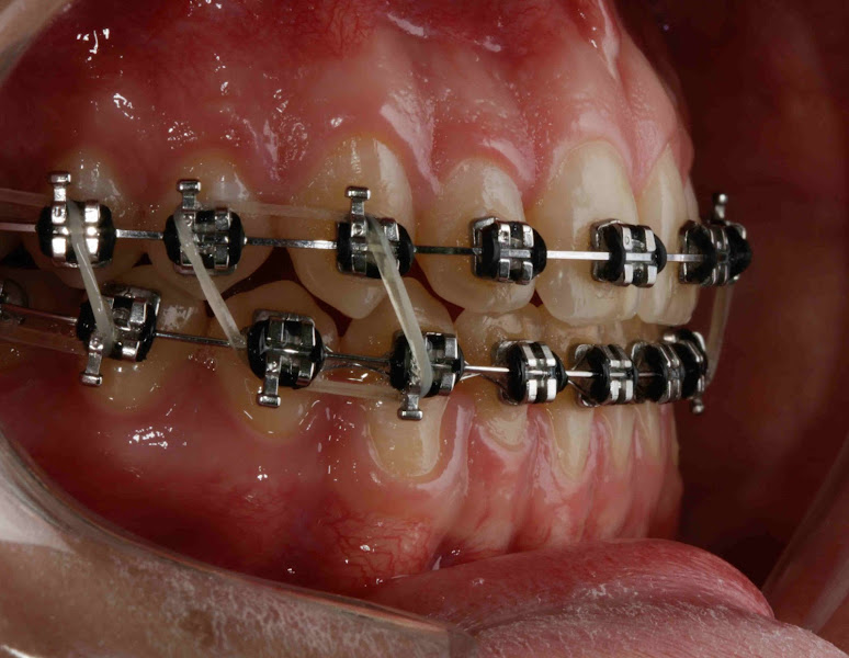 Foto 2 de Prevent Odontologia
