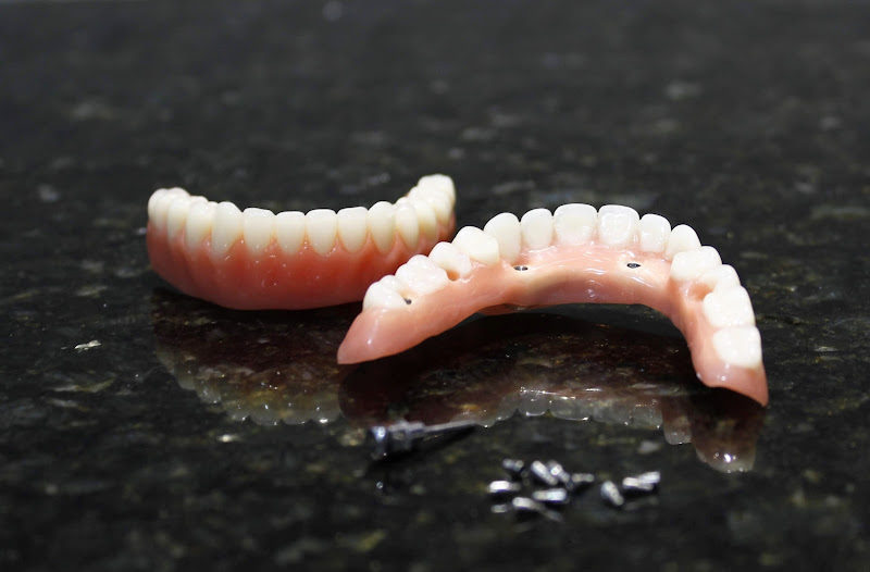 Foto 3 de Prevent Odontologia