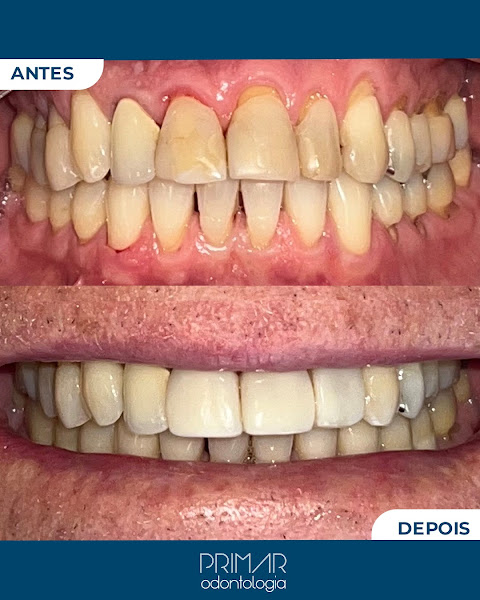 Foto 3 de Primar Odontologia