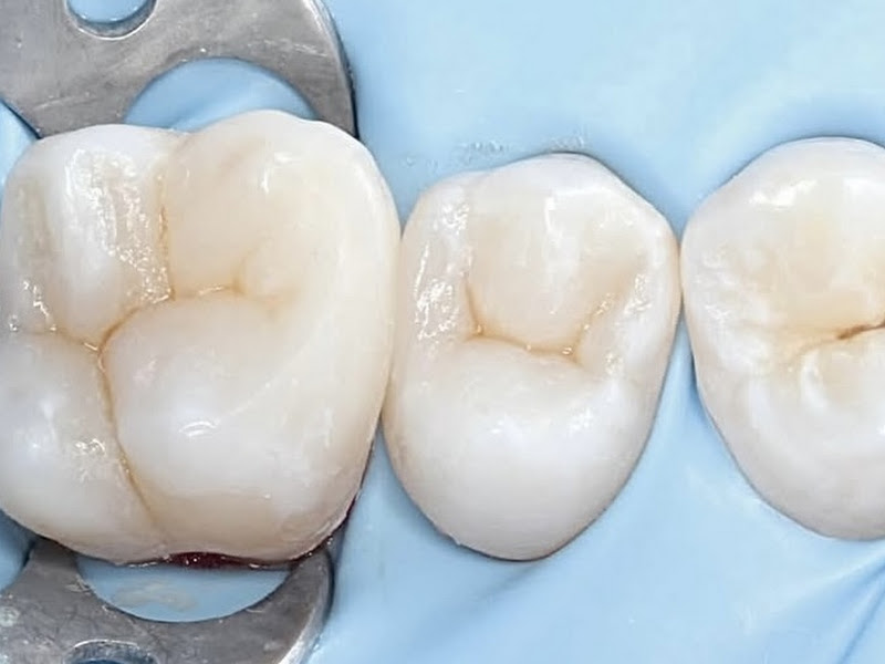 Foto 12 de Prime Clinic | Dentista em Juiz de Fora