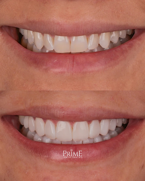 Foto 2 de Prime Lentes Dentais
