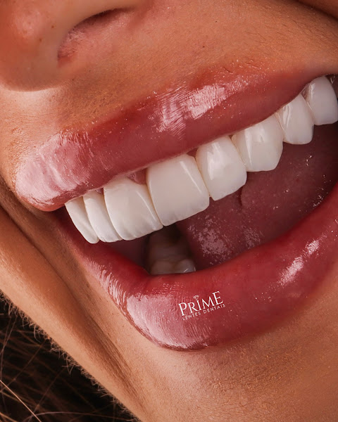 Foto 3 de Prime Lentes Dentais