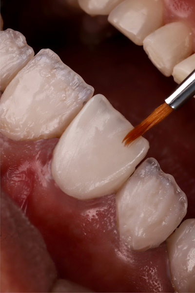 Foto 3 de Prime Lentes Dentais