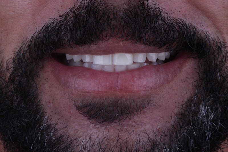 Foto 3 de Prime Lentes Dentais