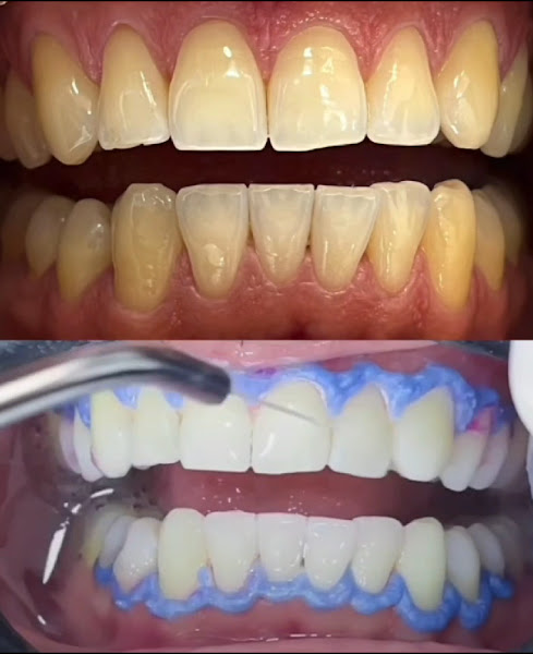 Foto 3 de PRIME ODONTO SP - IMIRIM