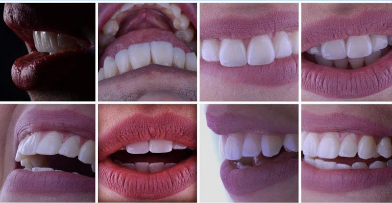 Foto 2 de Prime Odontologia