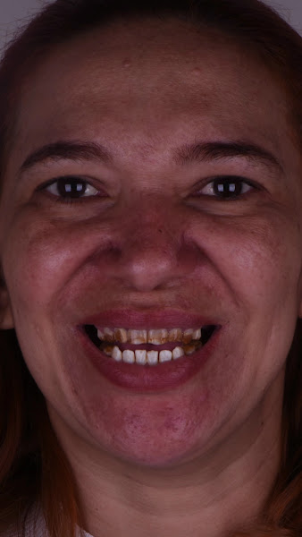 Foto 4 de Prime Odontologia