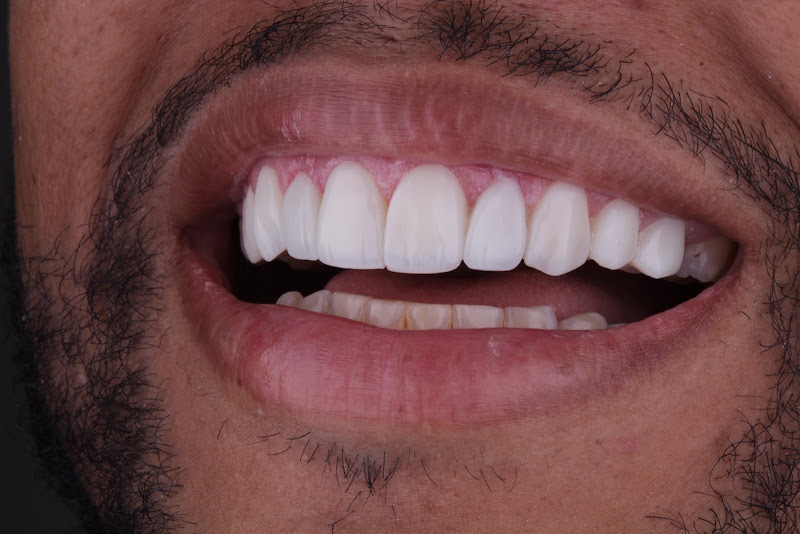 Foto 2 de Prime Odontologia - DENTISTA EM QUEIMADOS
