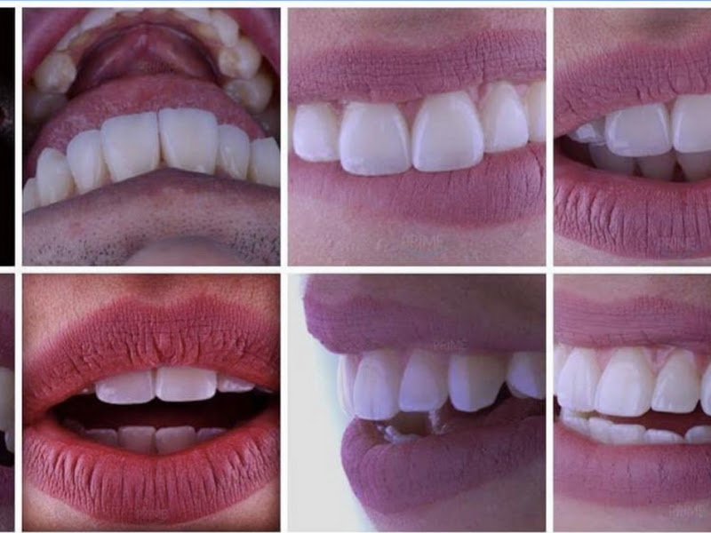 Foto 2 de Prime Odontologia Especializada