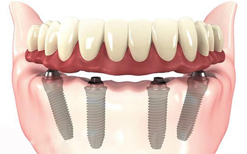 Foto 3 de Prime Odontologia Especializada - Dra. Michelle Vieira